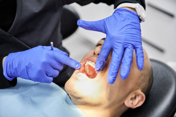 Best Emergency Gum Treatment in West Menlo Park, CA