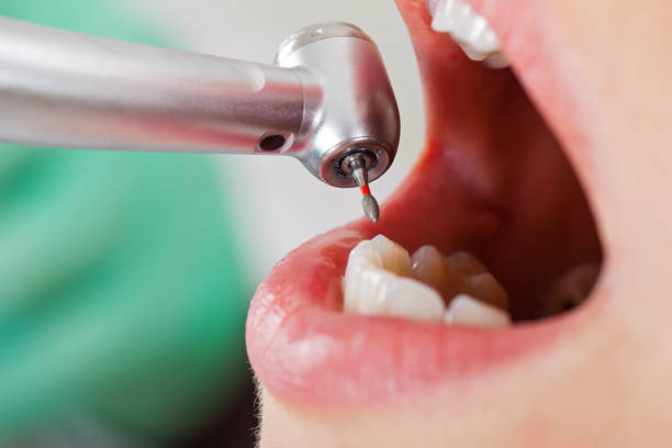 Best Same-Day Emergency Dental Services in West Menlo Park, CA